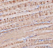 IHC staining of FFPE human skeletal muscle tissue with MOCS2 antibody. HIER: boil tissue sections in pH8 EDTA for 20 min and allow to cool before testing.