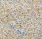 IHC staining of FFPE rat liver tissue with NUDT5 antibody. HIER: boil tissue sections in pH8 EDTA for 20 min and allow to cool before testing.