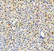 IHC staining of FFPE mouse liver tissue with NUDT5 antibody. HIER: boil tissue sections in pH8 EDTA for 20 min and allow to cool before testing.
