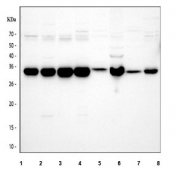 Western blot testing of 1) human Caco-2, 2) human 293T, 3) human Jurkat, 4) human HepG2 and 5) rat liver, 6) rat RH35, 7) mouse liver and 8) mouse HEPA1-6 cell lysate with NUDT5 antibody. Predicted molecular weight ~35 kDa.