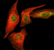 Immunofluorescent staining of FFPE human U-2 OS cells with NUDT5 antibody (green) and Beta Tubulin mAb (red). HIER: steam section in pH6 citrate buffer for 20 min.
