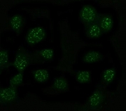 Immunofluorescent staining of FFPE human U-2 OS cells with MYT1L antibody (red) and DAPI nuclear stain (blue). HIER: steam section in pH6 citrate buffer for 20 min.