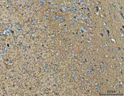 IHC staining of FFPE human mouse brain tissue with NPEPPS antibody. HIER: boil tissue sections in pH8 EDTA for 20 min and allow to cool before testing.