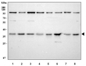 Western blot testing of 1) HeLa, 2) A549, 3) RT4, 4) U-251, 5) COLO-320, 6) HepG2, 7) U-2 OS and 8) 293T cell lysate with NUBP1 antibody. Predicted molecular weight ~35 kDa.