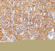 IHC staining of FFPE human kidney tissue with NUBP1 antibody, HRP-secondary and DAB substrate. HIER: boil tissue sections in pH8 EDTA for 20 min and allow to cool before testing.