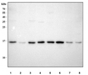Western blot testing of human 1) HeLa, 2) Jurkat, 3) HepG2, 4) PC-3, 5) U-251, 6) ThP-1, 7) A431 and 8) MCF-7 cell lysate with MYDGF antibody. Predicted molecular weight ~19 kDa, commonly observed at 14-19 kDa.