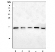 Western blot testing of 1) rat liver, 2) rat NRK, 3) mouse ovary, 4) mouse stomach and 5) mouse liver tissue lysate with MYDGF antibody. Predicted molecular weight ~19 kDa, commonly observed at 14-19 kDa.