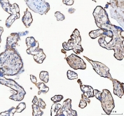 IHC staining of FFPE human placental tissue with MYDGF antibody. HIER: boil tissue sections in pH8 EDTA for 20 min and allow to cool before testing.
