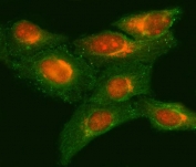 Immunofluorescent staining of FFPE human HeLa cells with NRMT antibody (red) and Beta Tubulin mAb (green). HIER: steam section in pH6 citrate buffer for 20 min.