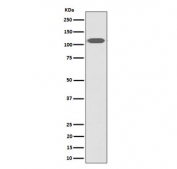 Western blot testing of human HeLa cell lysate with ZHX2 antibody. Predicted molecular weight ~92 kDa, commonly observed at 92-110 kDa.