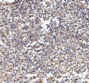IHC staining of FFPE human spleen tissue with MLEC antibody. HIER: boil tissue sections in pH8 EDTA for 20 min and allow to cool before testing.