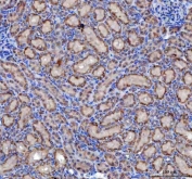 IHC staining of FFPE rat kidney tissue with MLEC antibody. HIER: boil tissue sections in pH8 EDTA for 20 min and allow to cool before testing.