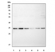 Western blot testing of human 1) RT4, 2) ThP-1, 3) A549, 4) SiHa, 5) A431 and 6) MCF7 cell lysate with MLEC antibody. Predicted molecular weight ~32 kDa.