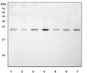 Western blot testing of human 1) SiHa, 2) RT4, 3) MCF7, 4) 293T, 5) Jurkat, 6) A431 and 7) Caco-2 cell lysate with MED29 antibody. Predicted molecular weight ~21 kDa.