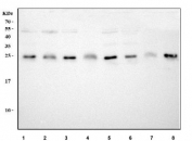 Western blot testing of human 1) RT4, 2) U-251, 3) 293T, 4) HL60, 5) HepG2, 6) A549, 7) U-2 OS and 8) SH-SY5Y cell lysate with NT5C antibody. Predicted molecular weight ~23 kDa.