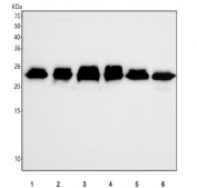 Western blot testing of 1) human 293T, 2) human HepG2, 3) human A549, 4) human RT4, 5) rat RH35 and 6) mouse HEPA1-6 cell lysate with RAB5C antibody. Predicted molecular weight ~23 kDa.