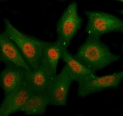 Immunofluorescent staining of FFPE human HeLa cells with CML66 antibody (red) and Beta Tubulin mAb (green). HIER: steam section in pH6 citrate buffer for 20 min.