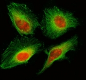Immunofluorescent staining of FFPE human HeLa cells with MIS18A antibody (red) and Beta Tubulin mAb (green). HIER: steam section in pH6 citrate buffer for 20 min.