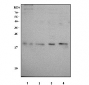 Western blot testing of human 1) LNCaP, 2) U-2 OS, 3) Caco-2 and 4) A431 cell lysate with NME6 antibody. Predicted molecular weight: ~13/18/21 kDa (multiple isoforms).
