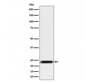 Western blot testing of human HEK293 cell lysate with ARFRP1 antibody. Predicted molecular weight ~23 kDa.