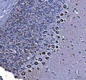 IHC staining of FFPE rat cerebellum tissue with MTCL1 antibody. HIER: boil tissue sections in pH8 EDTA for 20 min and allow to cool before testing.