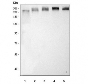 Western blot testing of 1) human RT4, 2) rat lung, 3) rat ovary, 4) mouse lung and 5) mouse ovary tissue with MTCL1 antibody. Predicted molecular weight ~210 kDa.