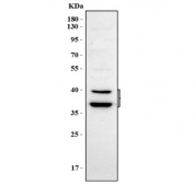 Western blot testing of human HEL cell lysate with PSTPIP2 antibody. Predicted molecular weight ~39/36 kDa (two isoforms).