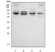 Western blot testing of human 1) SiHa, 2) U-87 MG, 3) A431 and 4) HaCaT cell lysate with RSPH3 antibody. Predicted molecular weight ~64 kDa and ~53 kDa (two isoforms).