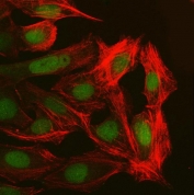 Immunofluorescent staining of FFPE human U-2 OS cells with NUP37 antibody (green) and Phalloidin (red). HIER: steam section in pH6 citrate buffer for 20 min.