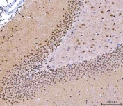 IHC staining of FFPE rat brain tissue with NUP37 antibody. HIER: boil tissue sections in pH8 EDTA for 20 min and allow to cool before testing.