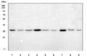 Western blot testing of 1) human HEL, 2) human K562, 3) human 293T, 4) human HepG2, 5) human ThP-1, 6) human HeLa, 7) rat liver, 8) rat RH35 and 9) mouse Neuro-2a cell lysate with METAP1D antibody. Predicted molecular weight ~37 kDa.