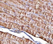 IHC staining of FFPE human skeletal muscle tissue with NT5C1A antibody. HIER: boil tissue sections in pH8 EDTA for 20 min and allow to cool before testing.