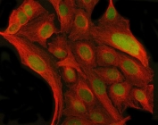 Immunofluorescent staining of FFPE human U-2 OS cells with Myoneurin antibody (green) and Beta Tubulin mAb (red). HIER: steam section in pH6 citrate buffer for 20 min.