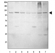 Western blot testing of 1) human Caco-2, 2) rat testis, 3) rat C6, 4) rat PC-12, 5) mouse testis, 6) mouse NIH 3T3 and 7) mouse RAW264.7 cell lysate with L1TD1 antibody. Predicted molecular weight ~99 kDa.