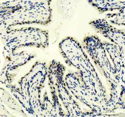 IHC staining of FFPE mouse bladder tissue with PUS7 antibody, HRP-secondary and DAB substrate. HIER: boil tissue sections in pH8 EDTA for 20 min and allow to cool before testing.
