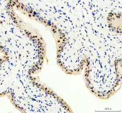 IHC staining of FFPE rat bladder tissue with PUS7 antibody, HRP-secondary and DAB substrate. HIER: boil tissue sections in pH8 EDTA for 20 min and allow to cool before testing.
