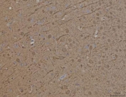 IHC staining of FFPE rat brain tissue with PRRT1 antibody. HIER: boil tissue sections in pH8 EDTA for 20 min and allow to cool before testing.