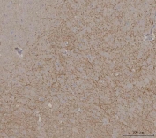 IHC staining of FFPE mouse brain tissue with PRRT1 antibody. HIER: boil tissue sections in pH8 EDTA for 20 min and allow to cool before testing.