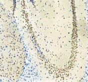 IHC staining of FFPE mouse brain tissue with PUS7L antibody, HRP-secondary and DAB substrate. HIER: boil tissue sections in pH8 EDTA for 20 min and allow to cool before testing.