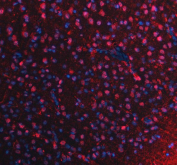 Immunofluorescent staining of FFPE rat brain tissue with PUS7L antibody (red) and DAPI nuclear stain (blue). HIER: steam section in pH8 EDTA buffer for 20 min.