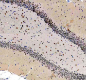 IHC staining of FFPE rat brain tissue with PUS7L antibody, HRP-secondary and DAB substrate. HIER: boil tissue sections in pH8 EDTA for 20 min and allow to cool before testing.