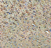 IHC staining of FFPE rat brain tissue with NPTXR antibody. HIER: boil tissue sections in pH8 EDTA for 20 min and allow to cool before testing.