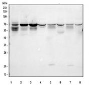Western blot testing of 1) human U-87 MG, 2) human SiHa and 3) rat C6 cell lysate with NPTXR antibody. Predicted molecular weight ~53 kDa but may be observed at higher molecular weights due to glycosylation.