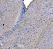 IHC staining of FFPE mouse brain tissue with MAP6D1 antibody. HIER: boil tissue sections in pH8 EDTA for 20 min and allow to cool before testing.
