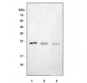 Western blot testing of 1) human T-47D, 2) rat brain and 3) mouse brain tissue with MAP6D1 antibody. Predicted molecular weight ~21 kDa.