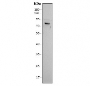 Western blot testing of human A375 cell lysate with MAGEC3 antibody. Predicted molecular weight ~72 kDa.