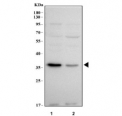 Western blot testing of human 1) A549 and 2) RT4 cell lysate with PROSER3 antibody. Predicted molecular weight ~51/35/21 kDa (multiple isoforms).