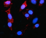 Immunofluorescent staining of FFPE human A549 cells with MAGED4 antibody (red) and DAPI nuclear stain (blue). HIER: steam section in pH6 citrate buffer for 20 min.