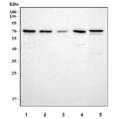 Western blot testing of 1) human RT4, 2) U-251, 3) SH-SY5Y, 4) HeLa and 5) rat liver tissue lysate with NTN3 antibody. Predicted molecular weight ~61 kDa but may be observed at higher molecular weights due to glycosylation.