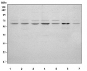 Western blot testing of human 1) Jurkat, 2) HaCaT, 3) HEL, 4) Caco-2, 5) K562, 6) A431 and 7) SH-SY5Y cell lysate with TMEM180 antibody. Predicted molecular weight ~57 kDa.